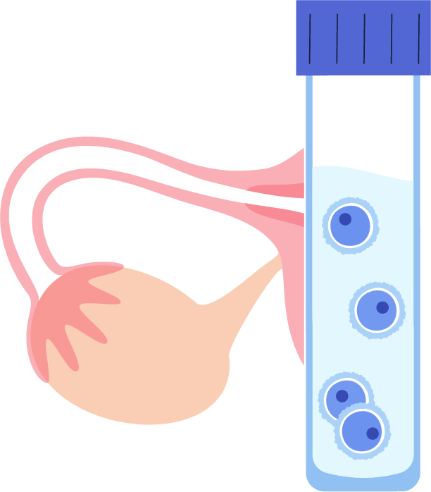 A test tube with a blood sample inside of it used for fertility treatment.