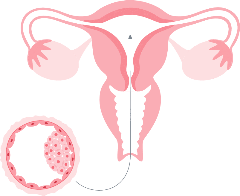 A woman's reproductive system, including the uterus and ovaries, is crucial for fertility and family planning. Additionally, advancements in assisted reproductive technologies like IVF have revolutionized the way couples can