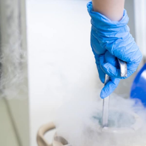 A person in blue gloves is performing a fertility treatment by carefully placing ice into a pot for an IVF procedure.
